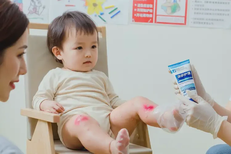 幼兒小腿容易長濕疹可以徹底自愈嗎(圖2)