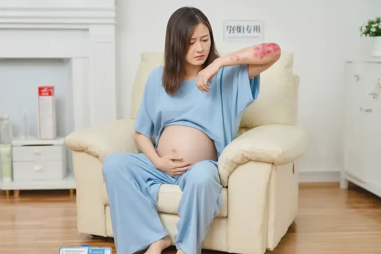 孕婦屁股上容易起濕疹可不可以徹底自愈(圖4)