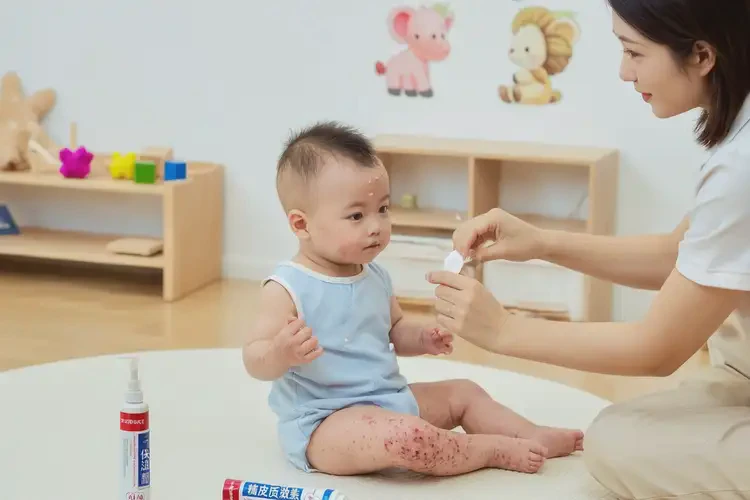 幼兒四肢起濕疹能夠徹底治愈嗎(圖2)