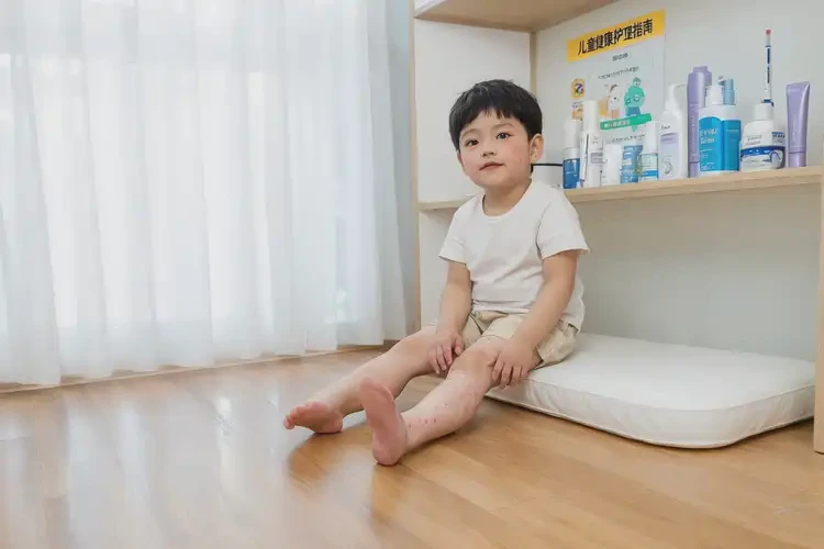 兒童大腿長濕疹不管它會自己痊愈嗎(圖4)