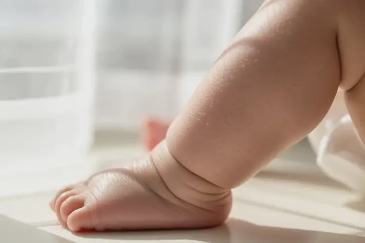 新生兒小腿上偶爾長濕疹可不可以根治(圖2)