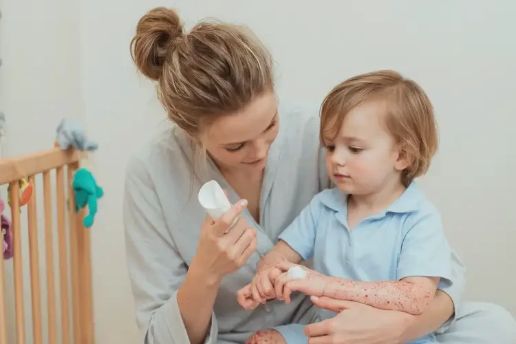 幼兒手臂上出濕疹可以徹底自愈嗎(圖3)