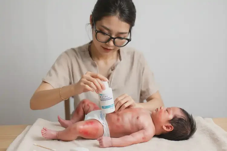 新生兒大腿上偶爾長(zhǎng)濕疹不管它會(huì)自己好嗎(圖3)