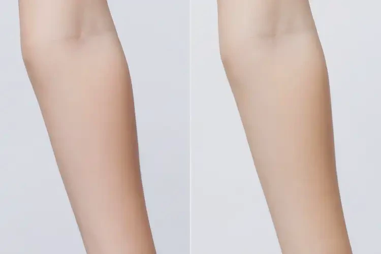 孩子手臂長濕疹不管它會自己自愈嗎(圖1)