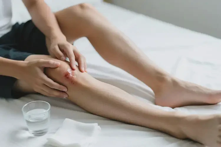 青少年身上經(jīng)常長(zhǎng)濕疹可不可以根治(圖1)