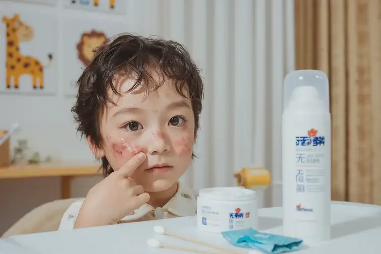 少儿脸上长湿疹可不可以根治(图2)