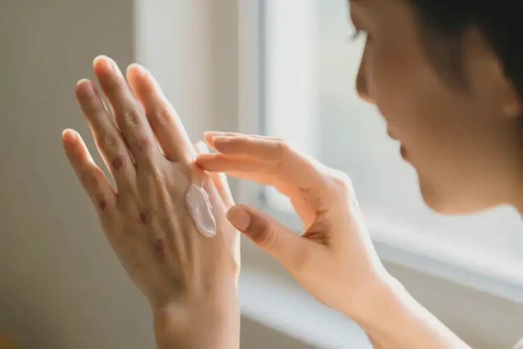 女人手上偶爾起濕疹能不能根治(圖4)