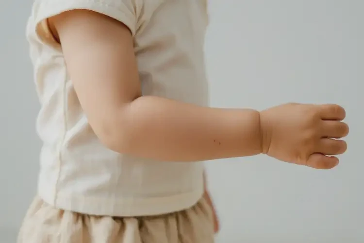 少兒手臂上偶爾長(zhǎng)濕疹能徹底自愈嗎(圖2)