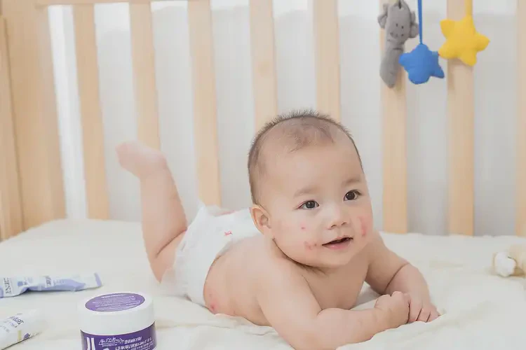 嬰兒屁股上出濕疹可以徹底自愈嗎(圖4)