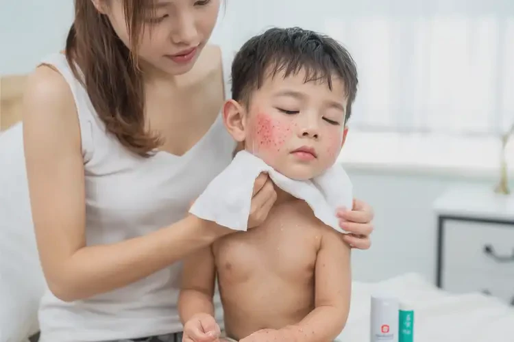 幼兒脖子有濕疹不管它會自己好嗎(圖2)