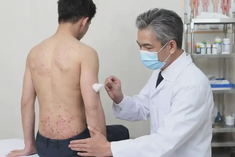 男性屁股上容易起濕疹可不可以根治(圖3)