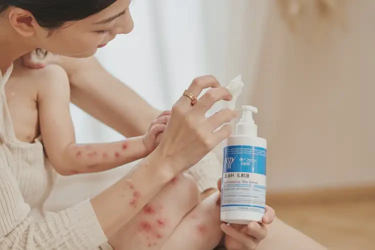 少儿手上偶尔起湿疹可不可以根治(图3)