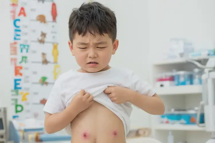 小孩肚子容易起濕疹不管它會(huì)自己好嗎(圖4)