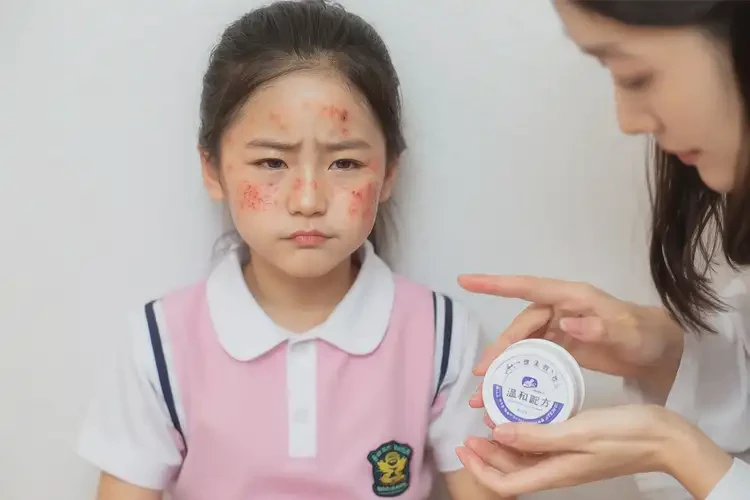 小學(xué)生臉上容易長濕疹不管它會(huì)自己自愈嗎(圖3)