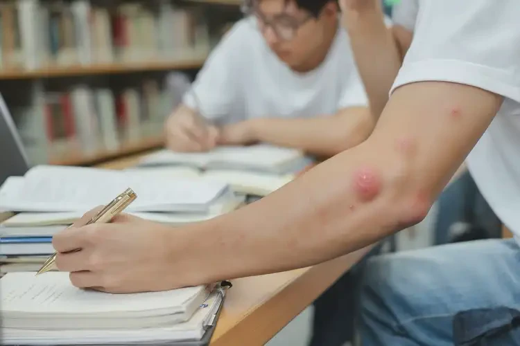 大学生身上偶尔长湿疹可以彻底自愈吗(图4)