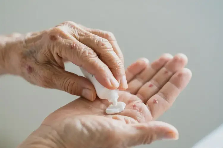 高齡老人手上出現(xiàn)濕疹能不能根治(圖3)