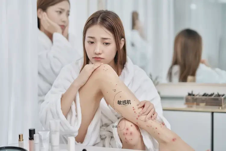 女生大腿上偶爾長(zhǎng)濕疹可不可以根治(圖4)