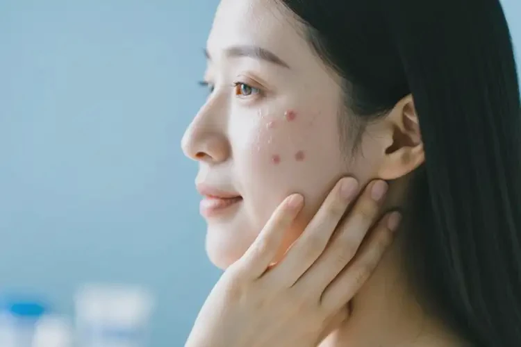 孕婦面部偶爾長濕疹不管它會自己痊愈嗎(圖2)