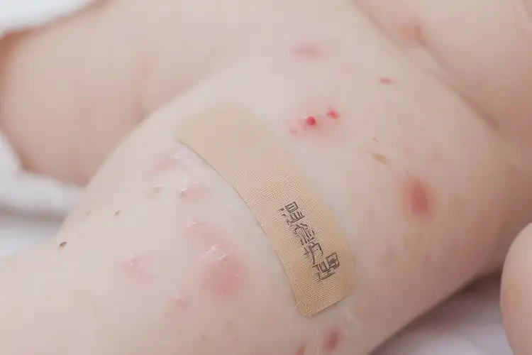 幼兒身上經常長濕疹能不能徹底自愈(圖4)