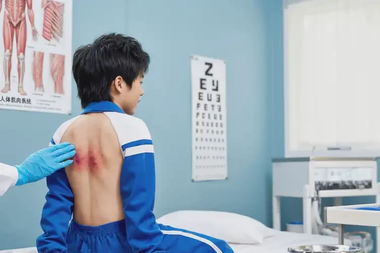 中學生肛周有濕疹可不可以根治(圖3)