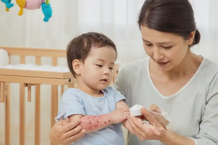 寶寶手臂上出現(xiàn)濕疹能靠自己自愈嗎(圖3)