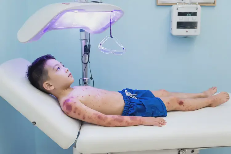 小兒臉上偶爾起濕疹不管它會自己自愈嗎(圖2)