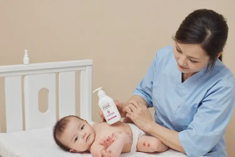嬰兒手臂上有濕疹可不可以根治(圖2)