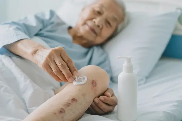 高龄老人小腿上出湿疹可以彻底自愈吗(图1)