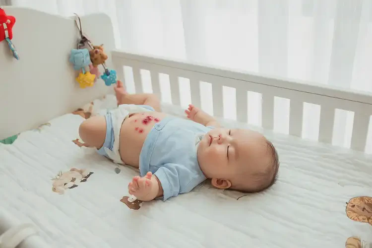 婴儿肚子偶尔起湿疹可不可以根治(图4)