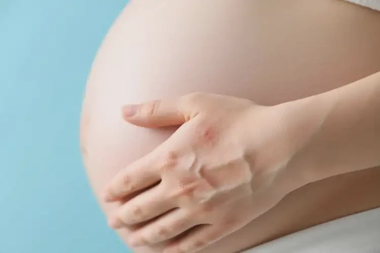 孕婦身上經(jīng)常長(zhǎng)濕疹可不可以根治(圖4)