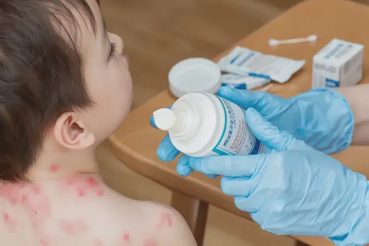 小兒脖子偶爾長(zhǎng)濕疹可不可以根治(圖2)