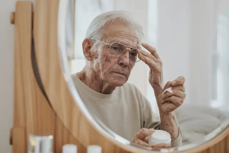 高齡老人面部出現(xiàn)濕疹能不能根治(圖3)