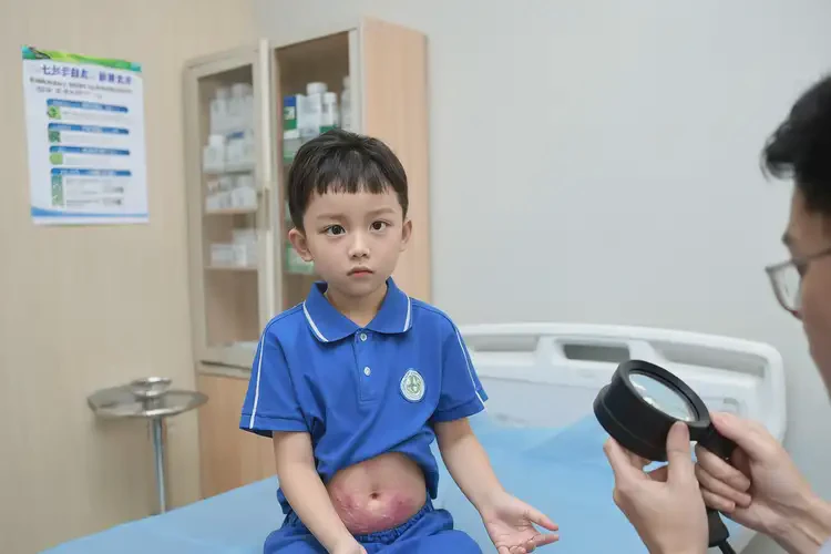 小學生肚子偶爾起濕疹能徹底自愈嗎(圖4)