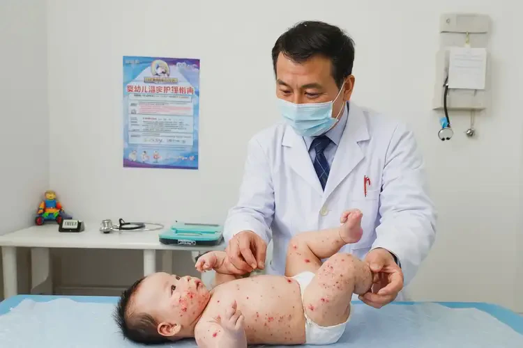 嬰兒全身長濕疹可不可以根治(圖2)