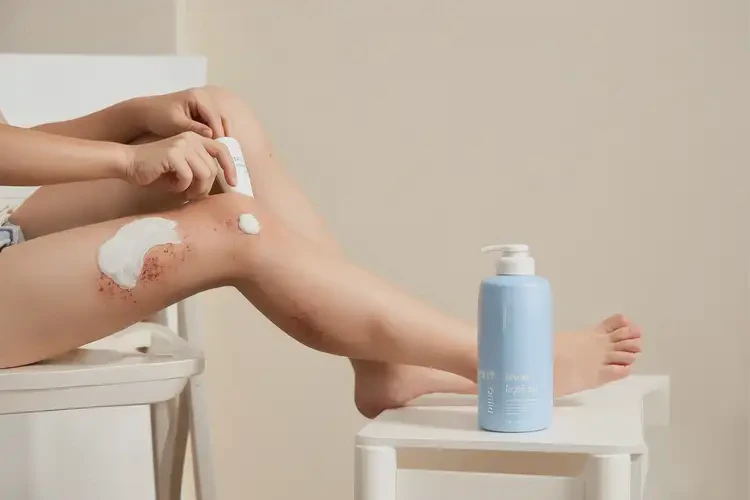 青少年大腿上偶爾起濕疹不管它會自己痊愈嗎(圖3)