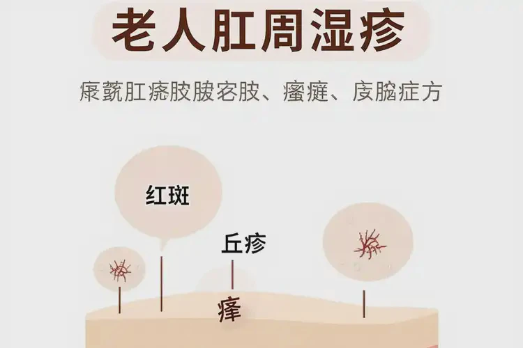 老年人肛周起濕疹可不可以徹底自愈(圖4)