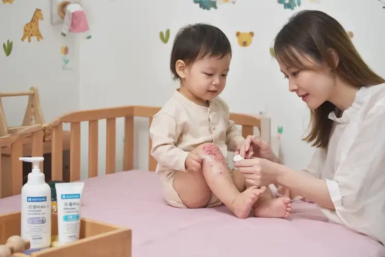 寶寶小腿上長濕疹可不可以根治(圖3)