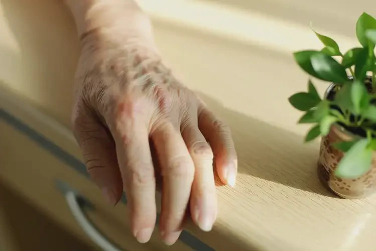 老年人手上長濕疹可不可以徹底自愈(圖4)