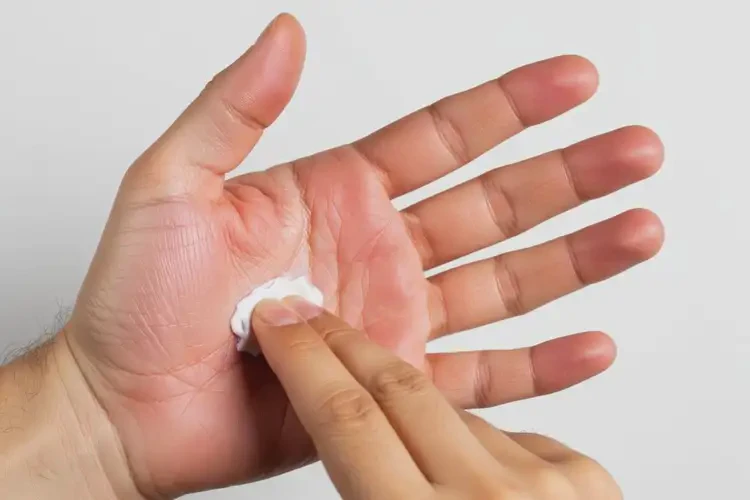 男人手上起湿疹能不能根治(图4)