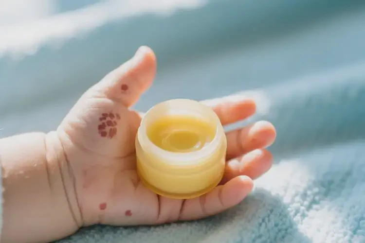 寶寶手上出濕疹可不可以根治(圖2)