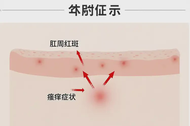 老年人肛周经常长湿疹不管它会自己痊愈吗(图4)