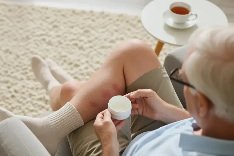 高齡老人小腿上容易長(zhǎng)濕疹可以徹底自愈嗎(圖1)