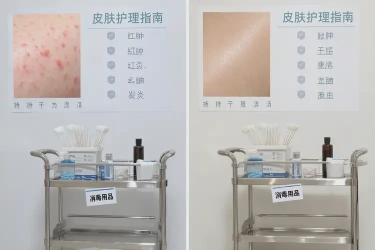 女人肛周有濕疹能夠徹底治愈嗎(圖2)