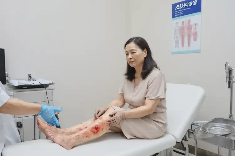 女人小腿上偶爾起濕疹能不能根治(圖4)