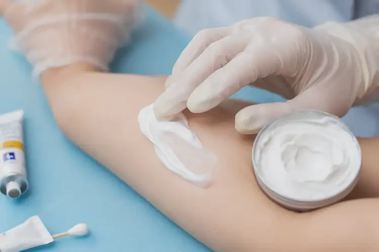 兒童屁股有濕疹能夠徹底治愈嗎(圖2)