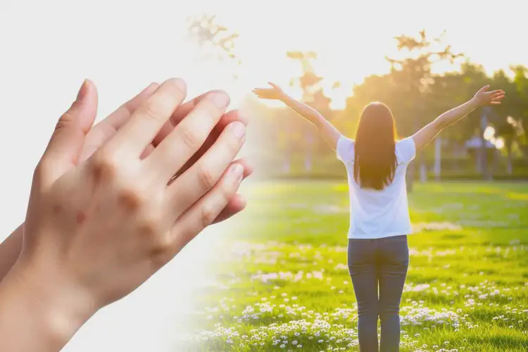 青年人四肢出現(xiàn)濕疹不管它會(huì)自己痊愈嗎(圖4)