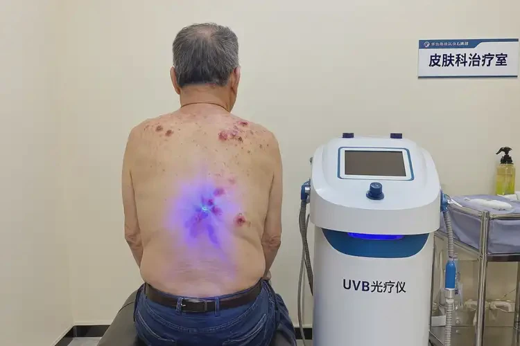 男生屁股上經(jīng)常長濕疹可不可以根治(圖1)