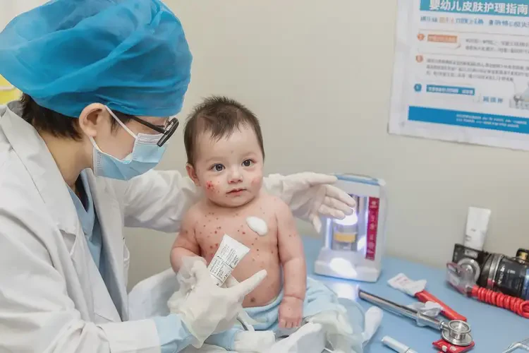 寶寶四肢起濕疹可不可以根治(圖3)