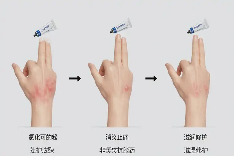 男人手上經(jīng)常長濕疹能不能根治(圖2)