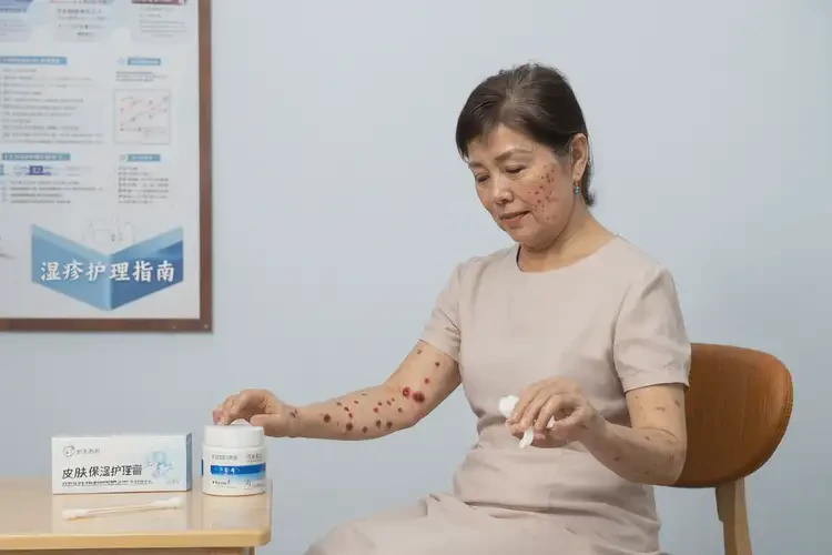 女性小腿出濕疹可不可以根治(圖4)